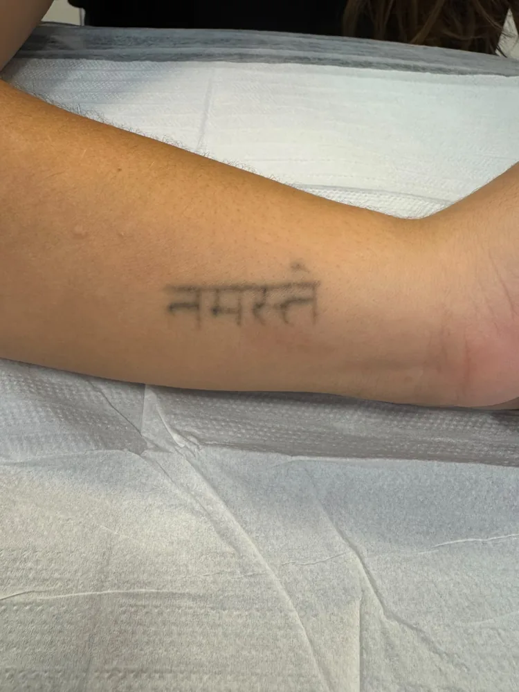 Tatuagem em sânscrito no antebraço, antes do tratamento